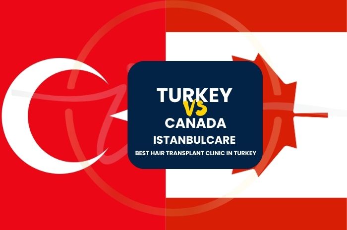 Hair Transplant Cost: Turkey vs. Canada